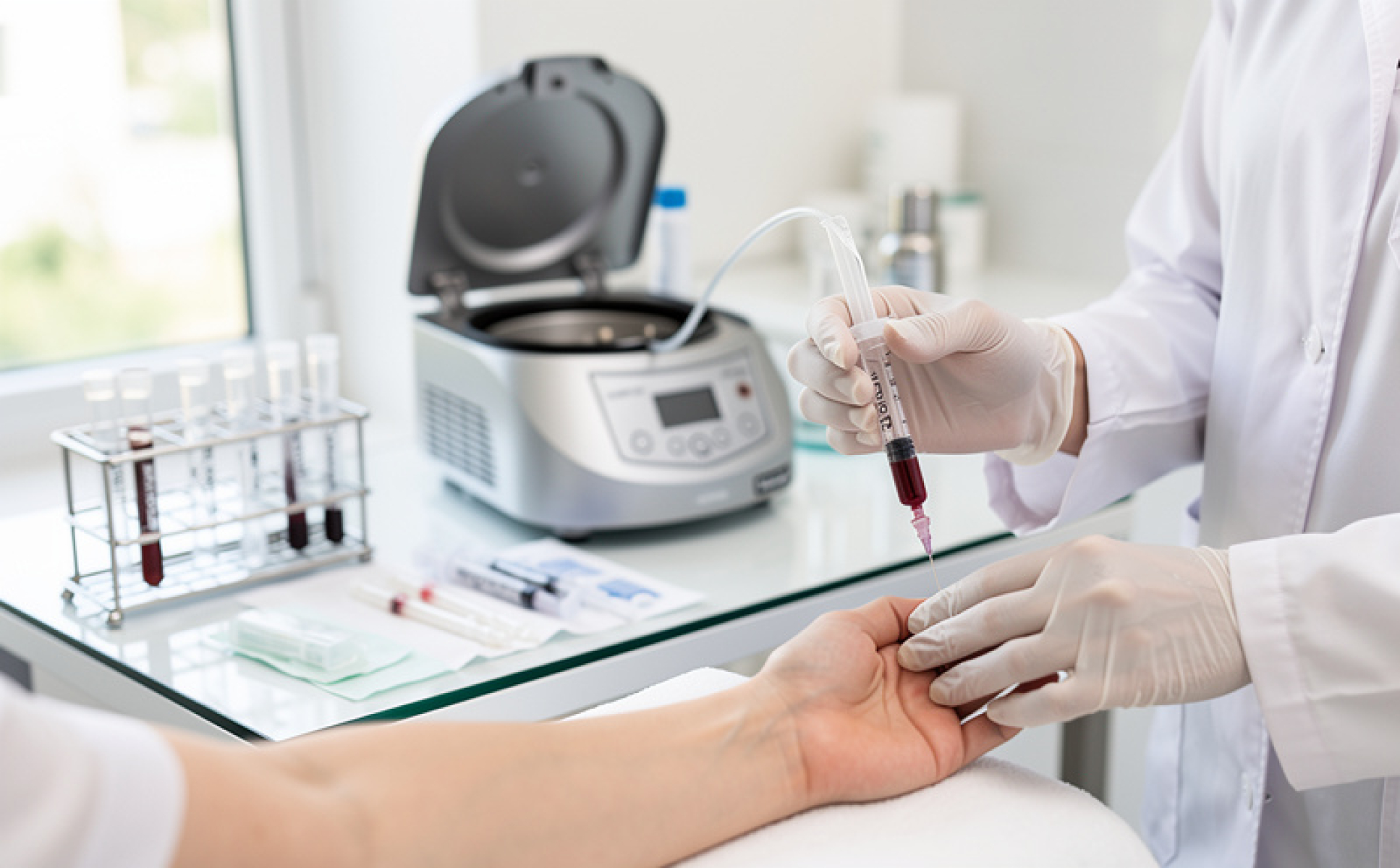 Thérapie Capillaire PRP & Cellules Souches 2025 : Alternatives Non-Chirurgicales