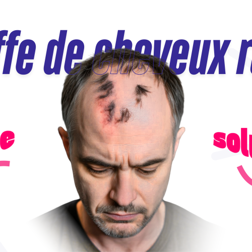 Greffe de cheveux ratée : Causes, solutions et conseils pour une correction réussie