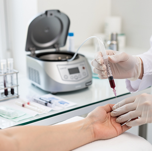 Thérapie Capillaire PRP & Cellules Souches 2025 : Alternatives Non-Chirurgicales